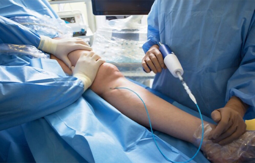 angiologia y cirugía vascular