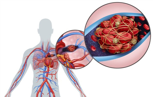 angiologo en alvaro obregon