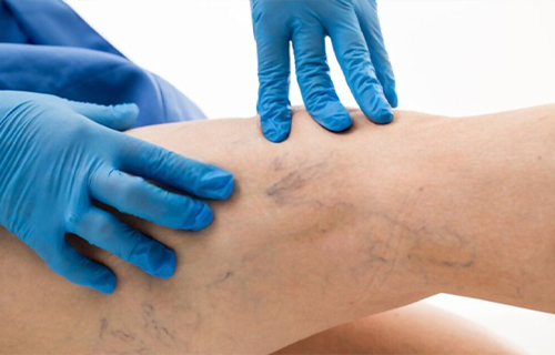 angiologo en guadalupe inn