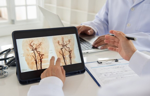 angiologo en star médica tlalnepantla