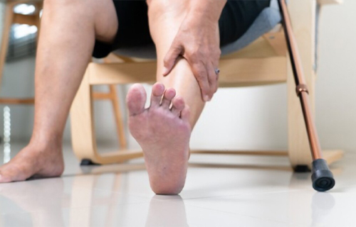 Angiologo pie diabetico