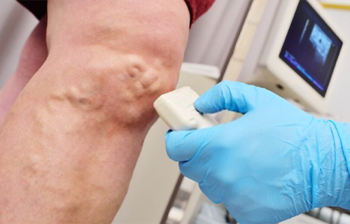 cuanto cobra un angiologo