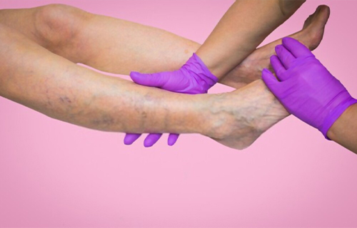 especialista en angiologia