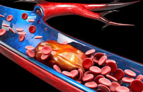 medico cirujano vascular